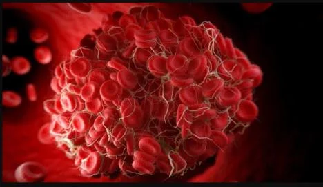 Blood Clotting Blood Clotting